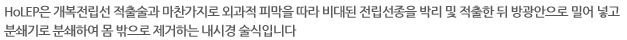 HoLEP은 개복전립선 적출술과 마찬가지로 외과적 피막을 따라 비대된 전립선종을 박리 및 적출한 뒤 방광안으로 밀어 넣고 분쇄기로 분쇄하여 몸 밖으로 제거하는 내시경 술식입니다. 