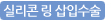 실리콘 링 삽입 수술