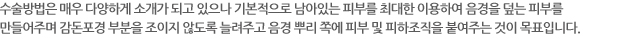 수술방법은 매우 다양하게 소개가 되고 있으나 기본적으로 남아있는 피부를 최대한 이용하여 음경을 덮는 피부를 만들어주며 감돈포경 부분을 조이지 않도록 늘려주고 음경 뿌리 쪽에 피부 및 피하조직을 붙여주는 것이 목표입니다.