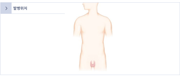 음낭수종 발병위치  이미지